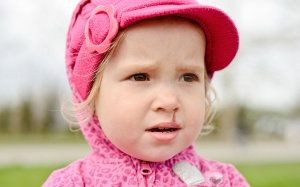 Trẻ bị chảy máu cam: 15 nguyên nhân gây chảy máu cam ở trẻ