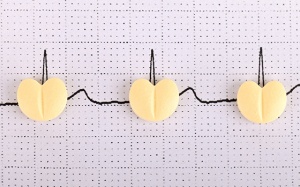 Dùng thuốc điều trị rối loạn nhịp tim cần lưu ý gì?