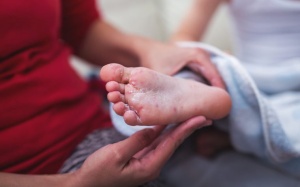 9 điều cha mẹ cần biết về bệnh tay chân miệng