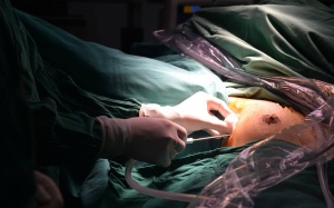 Việt Nam là nước đầu tiên trên thế giới mổ nội soi tuyến giáp một lỗ