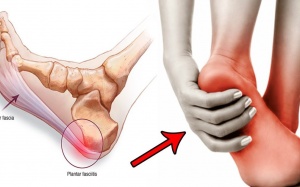 Đau gót bàn chân và gót chân do đâu?