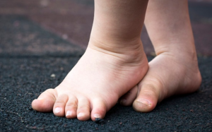 Trẻ bị đau cổ chân, mắt cá chân do đâu? 