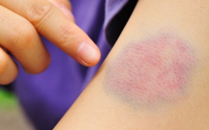 Những dấu hiệu của cơ thể cảnh báo bạn đang bị thiếu vi chất