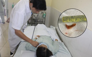 Giải cứu cho cô gái hóc xương vịt trong 3 tháng