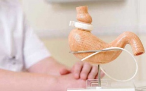 Phẫu thuật giảm cân có thể làm tăng nguy cơ mắc sỏi mật