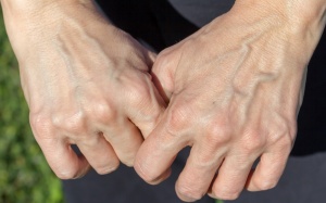 Tay, chân nổi gân xanh cảnh báo điều gì về sức khỏe?