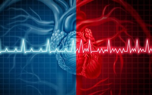 Rung nhĩ là gì và những ai có nguy cơ cao mắc bệnh rung nhĩ?