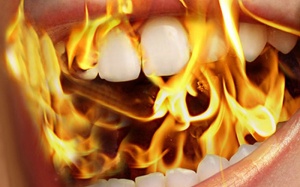 Bị nóng rát miệng, khô miệng có phải do mãn kinh?