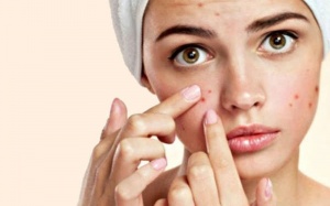 Những sai lầm trong chế độ ăn uống gây mụn trứng cá