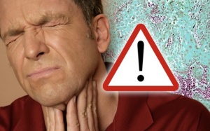 10 dấu hiệu cảnh báo ung thư thường bị nam giới bỏ qua