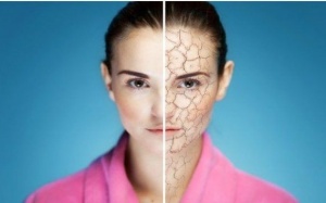 3 nguyên nhân hàng đầu khiến da khô vào mùa Đông