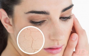 Mùa Đông nên ăn những loại thực phẩm này để tránh khô da!