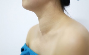 Bướu giáp 15 năm không điều trị, bệnh nhân gặp nguy do khối u chèn ép khí quản