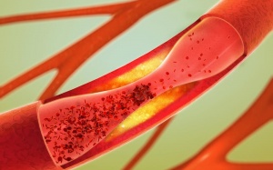 5 cách giúp động mạch luôn khỏe, phòng ngừa đau tim