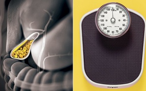 Chế độ ăn kiêng nghiêm ngặt, giảm cân quá nhanh có thể gây sỏi mật?