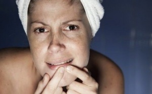 5 cách giúp bạn làm giảm viêm da hiệu quả