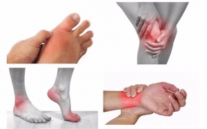 6 dấu hiệu cảnh báo viêm khớp