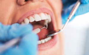 5 lời khuyên giúp ngăn ngừa sâu răng tối ưu