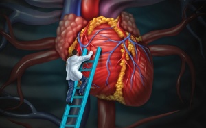 Có những phương pháp điều trị thiếu máu cơ tim nào?