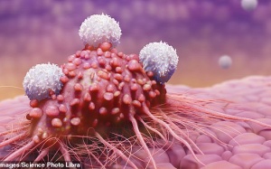 Đột phá: Truyền tế bào miễn dịch vào người bệnh để điều trị ung thư