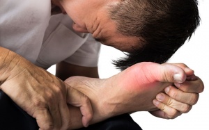 Những nguyên nhân có thể gây bệnh gout