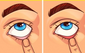 7 mẹo đơn giản giúp kiểm tra sức khỏe của bạn tại nhà trước Tết 