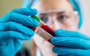Anh: Xét nghiệm máu mới giúp phát hiện sớm ung thư phổi