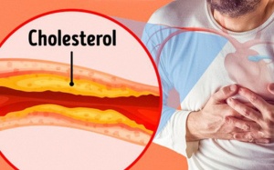 Ăn gì để làm sạch động mạch và giảm nguy cơ mắc bệnh tim?