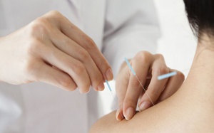 Tại sao bạn nên thử phương pháp châm cứu khi bị đau cổ?