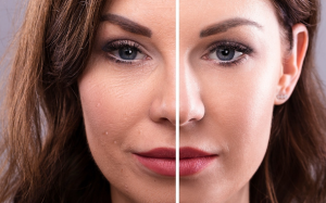 9 bước tập yoga mặt giúp loại bỏ mỡ mặt và ngăn ngừa nếp nhăn