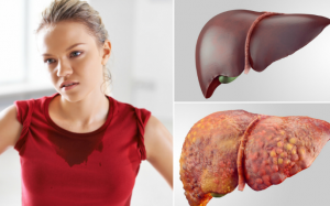 6 bước làm sạch gan, detox gan dễ thực hiện 