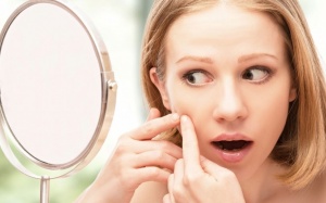 7 mẹo chăm sóc da cho người bị mụn