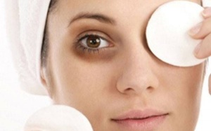 Ngủ đủ giấc nhưng mắt vẫn bị thâm quầng do đâu?