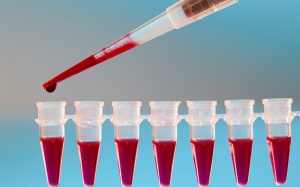 Có phải dùng thuốc chống đông máu cả đời khi bị rung tâm nhĩ? 