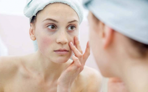 Quầng thâm và bọng mắt: Thực phẩm chính là thủ phạm!