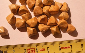 Mọi điều bạn cần biết về bệnh sỏi gan