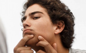 Viêm da tiết bã, mụn nhiều nên ăn uống thế nào?