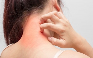 Những quan niệm sai lầm về dị ứng thực phẩm