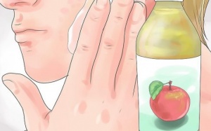 Dùng giấm táo thế nào mới trị mụn hiệu quả?