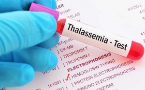 Vì sao các cặp vợ chồng nên sàng lọc thalassemia trước khi kết hôn? 