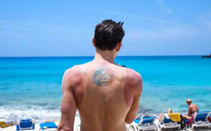 Da bị cháy nắng nguy hiểm như thế nào? 