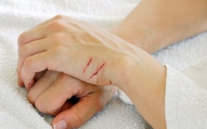 Viêm mô tế bào có nguy hiểm không? 