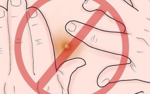 Trị nhọt siêu tốc bằng phương pháp tự nhiên