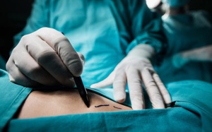 Khi nào cần mổ sỏi mật và phẫu thuật này có nguy hiểm không?