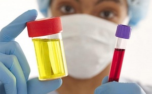 Nước tiểu có lẫn máu có nguy hiêm?