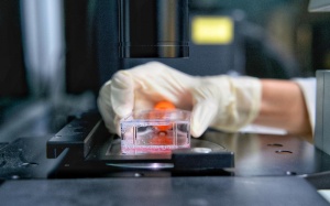 Tìm ra cách thức vitamin D tấn công 'gót chân Asin' của ung thư kháng thuốc