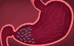 5 dấu hiệu cảnh báo bạn bị viêm loét dạ dày do nhiễm khuẩn HP