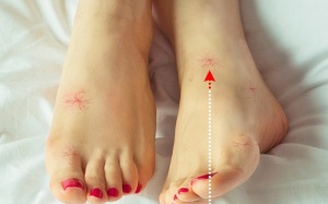 Những dấu hiệu ở chân cảnh báo bạn đang mắc bệnh nguy hiểm