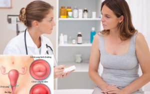 Viêm lộ tuyến cổ tử cung nên ăn gì, hạn chế ăn gì?