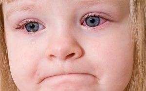 Trẻ nhỏ bị viêm kết mạc có phải dùng kháng sinh không?